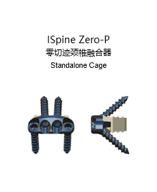 ISpine Zero 零切迹颈椎融合器